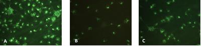 Tryptophan and Kynurenine Pathway Metabolites in Animal Models of Retinal and Optic Nerve Damage: Different Dynamics of Changes